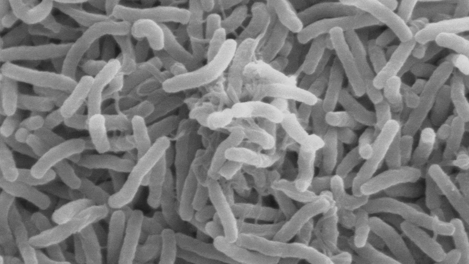 Scanning electron microscope image of Vibrio cholerae bacteria